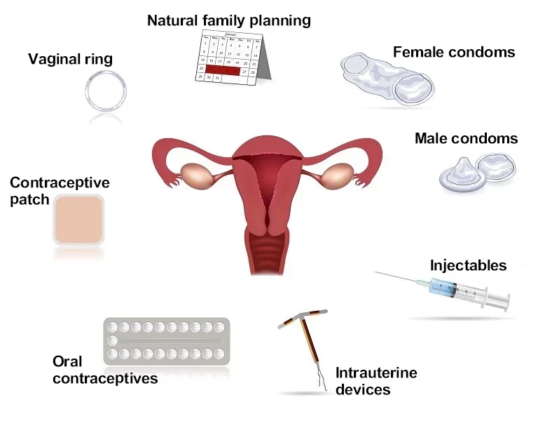 Contraceptive Methods