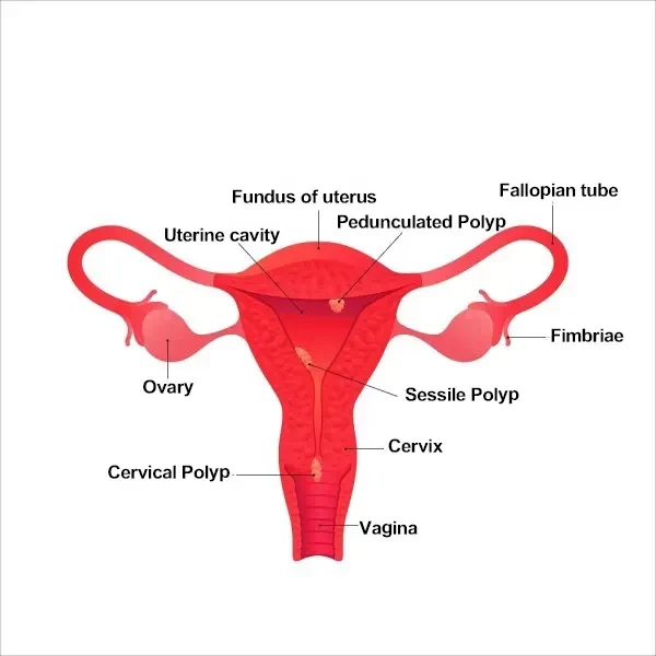 General Gynecological Issues